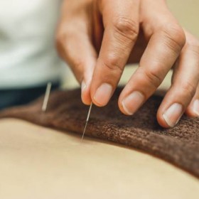 You Can Find The Best Chinese Acupuncture Specialists In Hove