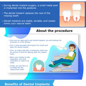 Most Trusted Dental Implant Surgeon in Elk Grove Village!