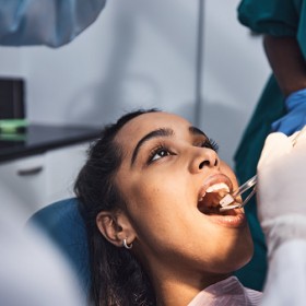 Benefits of Root Canal in Surprise AZ