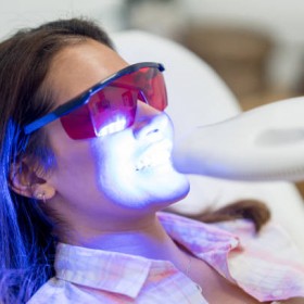 Safe & Effective Teeth Whitening In Kelowna For A Brighter Smile