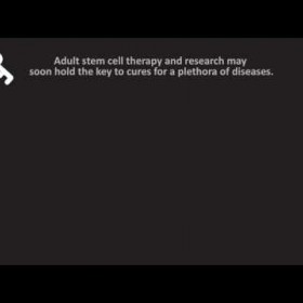 Stem Cell Therapy Los Angeles | 323-285-5300
