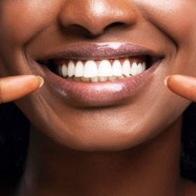 Your Premier Teeth Whitening Treatment In Charlotte NC