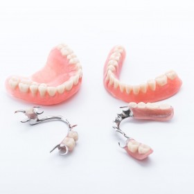 Affordable Full & Partial Dentures In Palm Coast