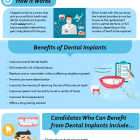 Dental Implant Placement & Restoration