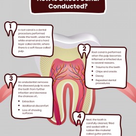 Endodontist Therapy Procedure Near Downtown Chicago