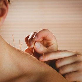 Unlock Natural Healing With Acupuncture Excellence in Asheville