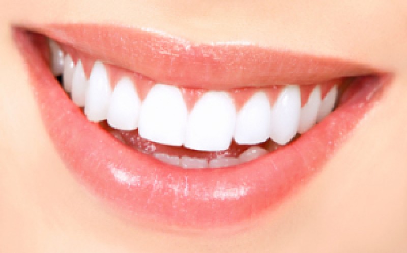 Whiten Your Teeth at Chanhassen Family Dentistry